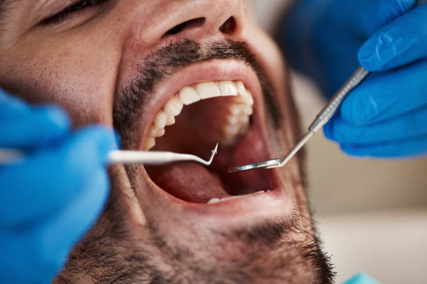 Dental X-Rays and Imaging in South Kensington, MD